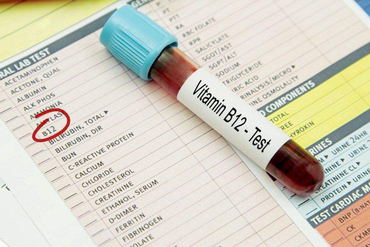 B12 vitamini ile diğer B vitaminleri arasındaki fark nedir?