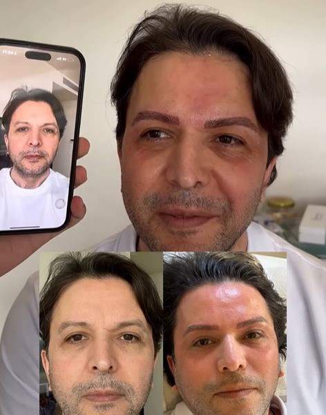 Nihat Doğan da estetik yaptırdı