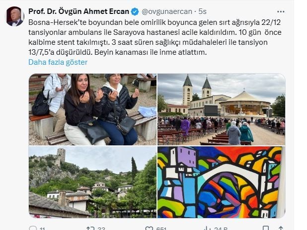 Prof. Dr. Övgün Ahmet Ercan beyin kanaması tehlikesi geçirdiğini duyurdu