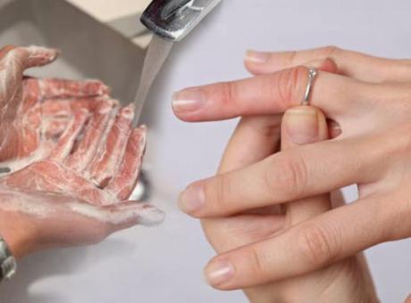 Sıkışan yüzüğü 1 hamlede çıkarıyor! 2 dakika tutup sürün: Diş ipiyle çekilmeli