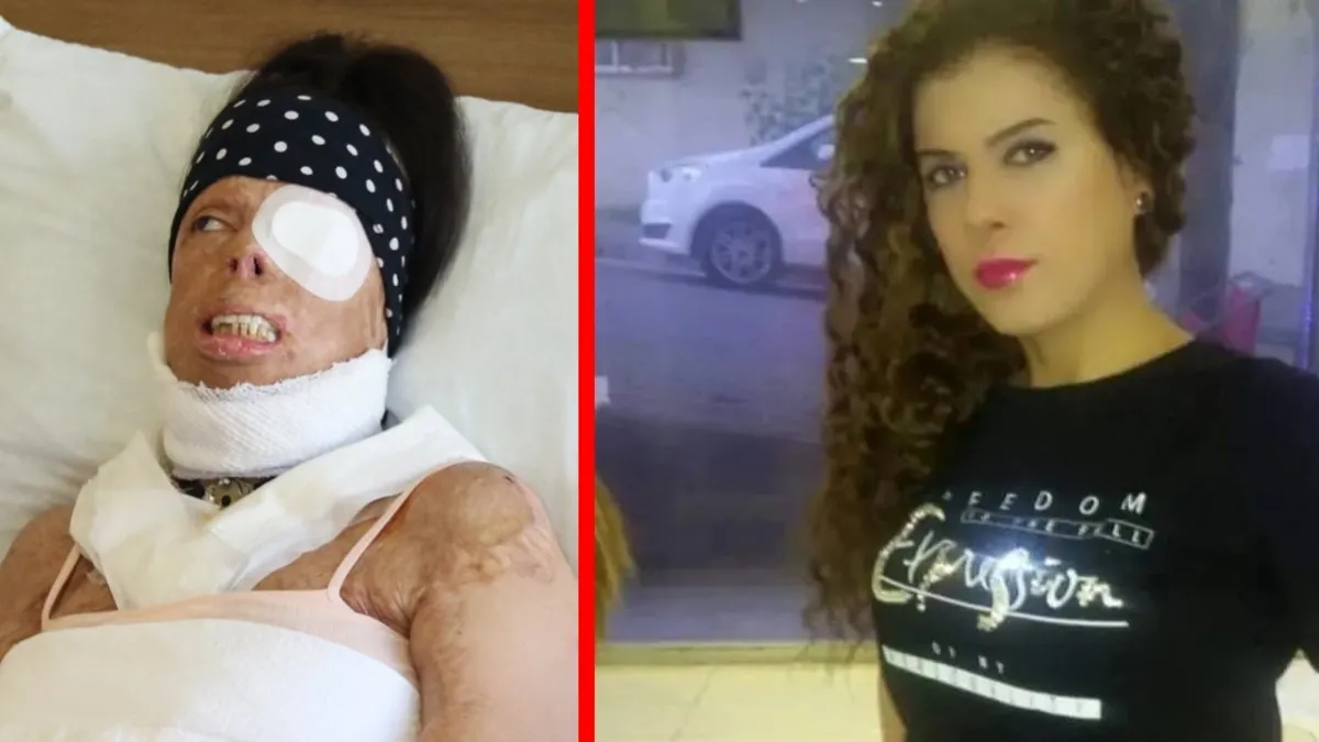 Eski sevgiliden kezzaplı vahşet! Yasemin’in anlattıkları kan dondurdu! “Yüzümü yıkamayayım diye suyu kesti”