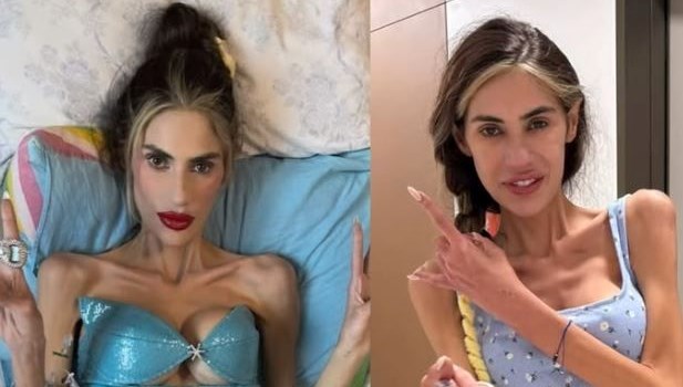 Nihal Candan kimdir, öldü mü? Anoreksiya ile mücadele eden Nihal Candan son durumu