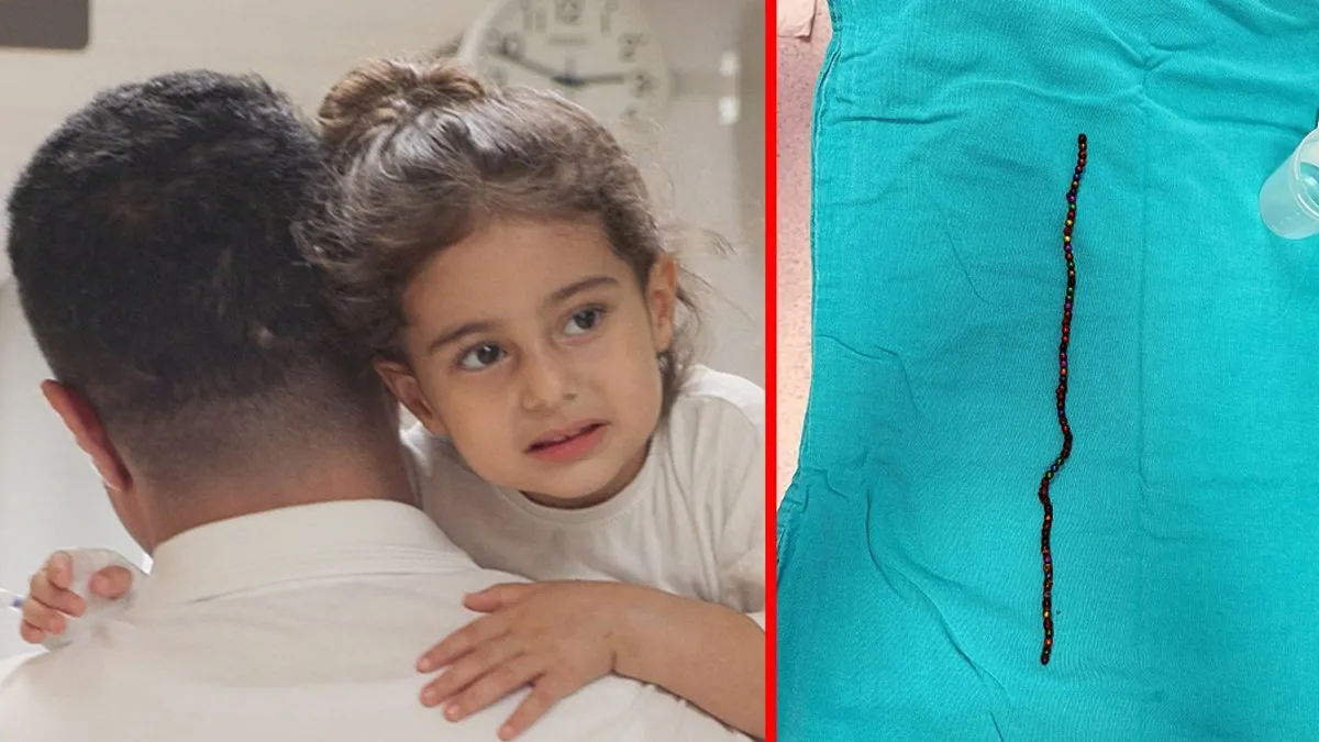 3 yaşındaki çocuğun karnından çıktı: Tam 66 adet! Doklar gözlerine inanamadı!