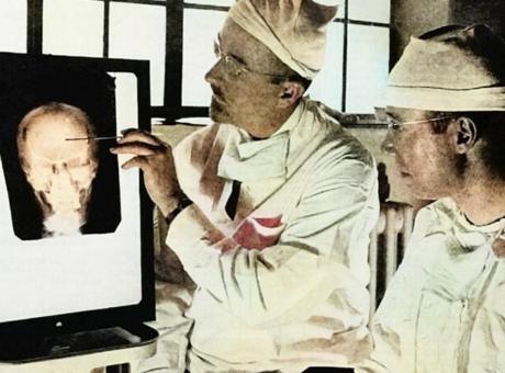 Buz kıracağıyla beyin ameliyatı! 10 dakikada ölüm: Nobel ödüllü ‘tedavi’ 500 can aldı