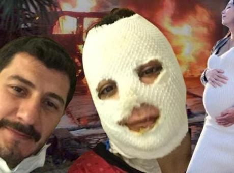Yaptığı şakayı 15 gün sonra yaşadı! Irak’ta bombaların hedefi oldu: ‘Öldüm sandım’