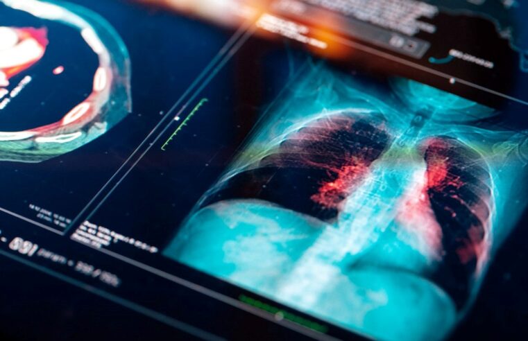 Sigara içmeyenlerde neden Akciğer kanseri görülüyor: 5 nedeni var